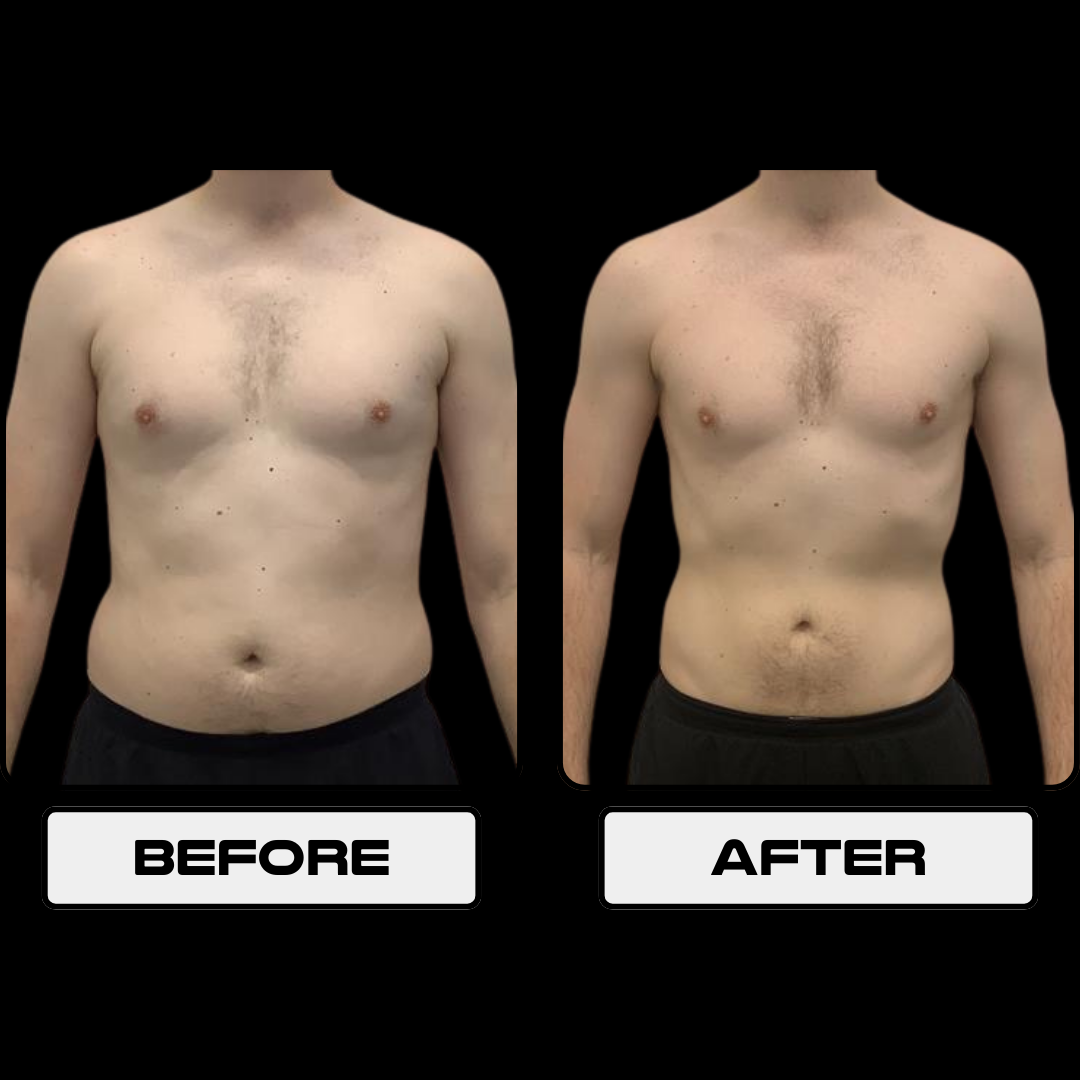 Dan McGurty before and after