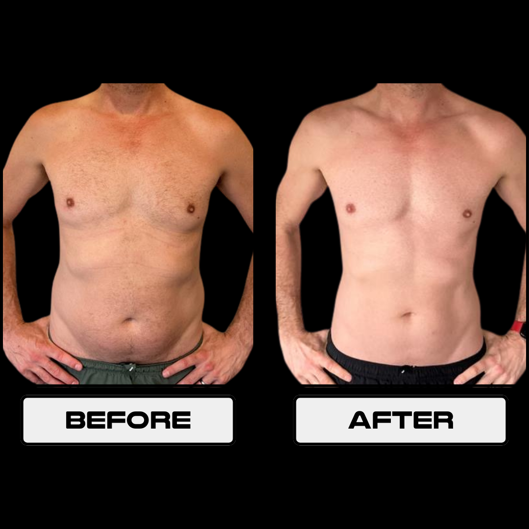 Jeremy Stevens before and after