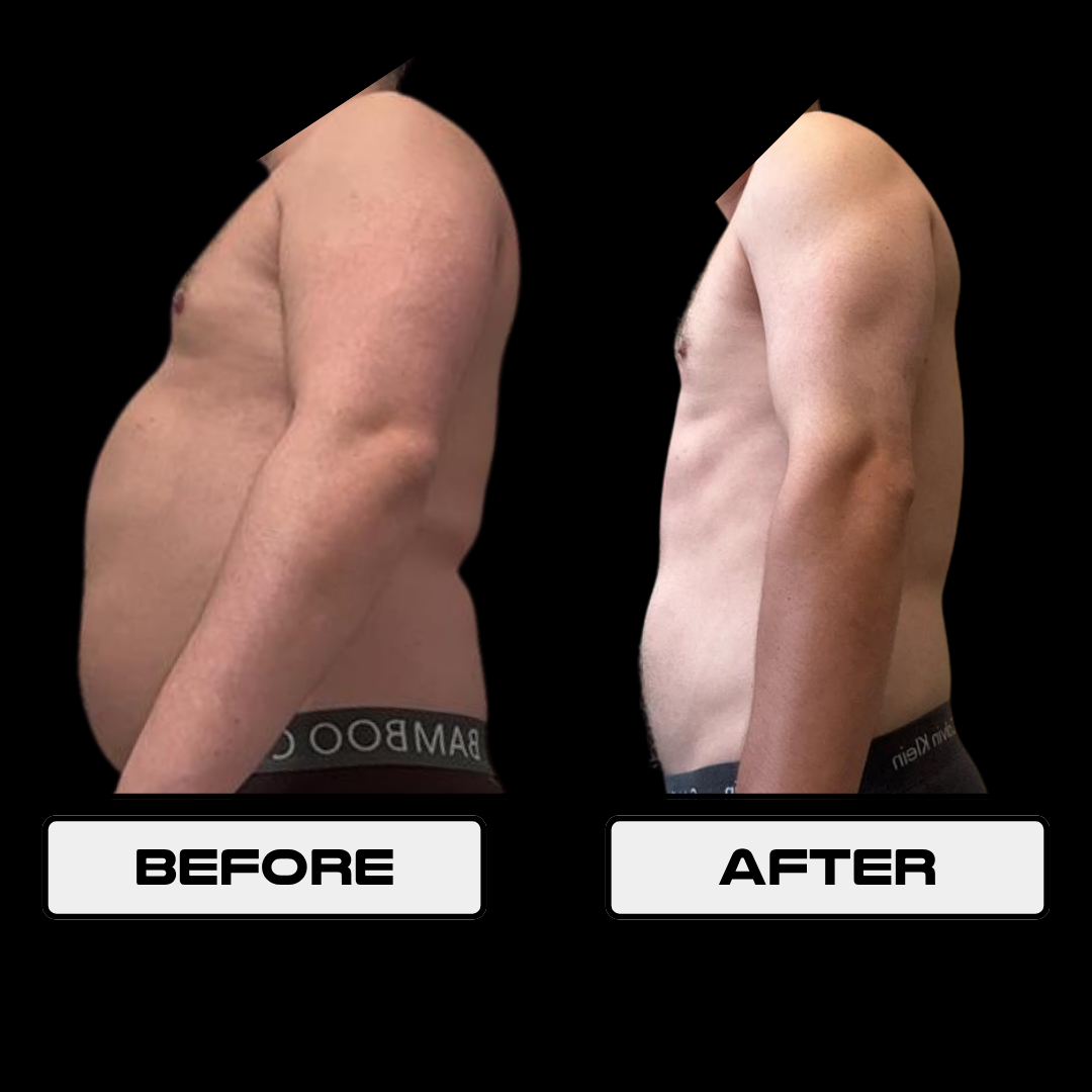 Max Pancamo before and after