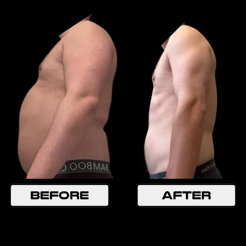 Max Pancamo before and after